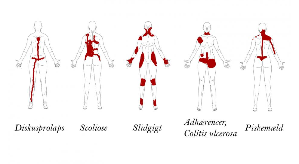 Body diagrams from CNAP. 