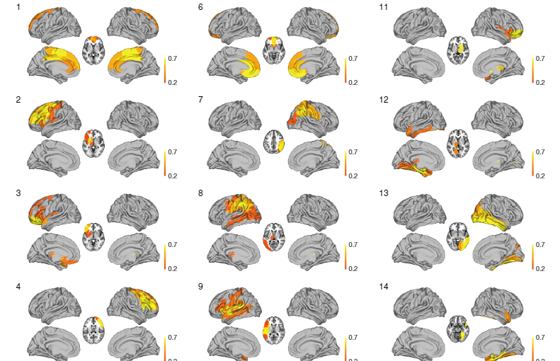 Videnskabelig illustration af scanningsbillede af menneskehjerner.