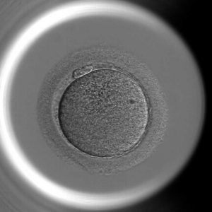Billedet viser forstørrelsen af én af de 3000 ægceller, der indgik i undersøgelsen.