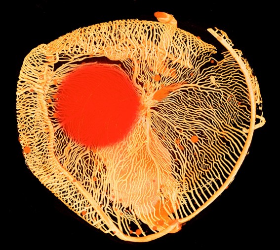 The picture shows a scan of an eye from the Antarctic ice fish. Researchers are specifically interested in the fish because its blood is missing the protein hemoglobin that normally transports oxygen in the body and colors the blood red. 