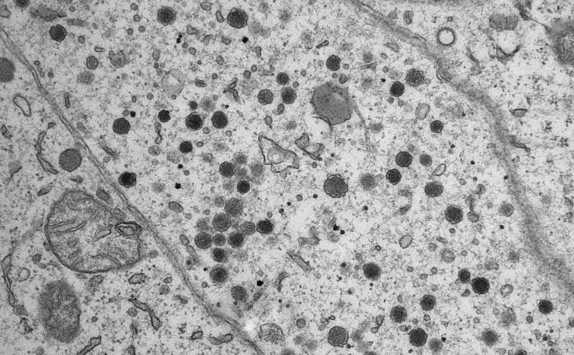 Billedet er taget gennem et elektronmikroskop viser en slags granula der indeholder peptidhormoner Foto: CCG