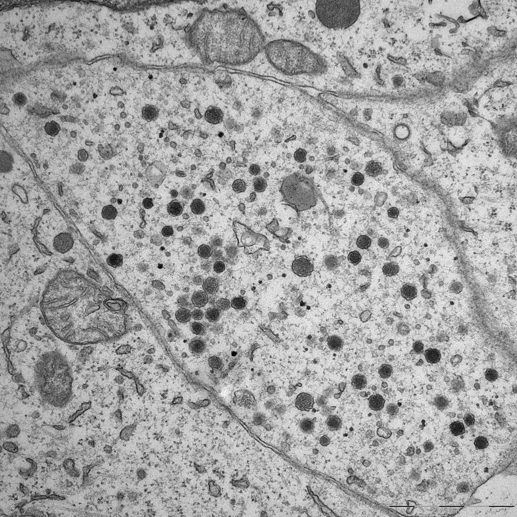 Billedet er taget gennem et elektronmikroskop, og viser en form for granula der indeholder peptidhormoner Foto: CCG